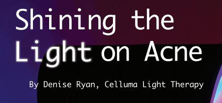 Shining the Light on Acne